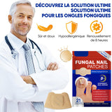Plaques fongiques sur les ongles