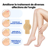 Plaques fongiques sur les ongles