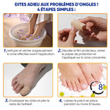 Plaques fongiques sur les ongles