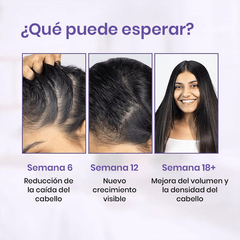 Sérum roll-on avanzado para el crecimiento del cabello