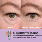 Tensador temporal de ojos