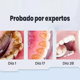 Super Probiotic-6 Pasta Dental Blanqueadora con Probióticos