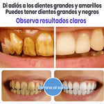 Super Probiotic-6 Pasta Dental Blanqueadora con Probióticos