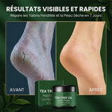 Crème pour les pieds à l’huile d’arbre à thé