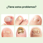 Gotas mágicas reparadoras de uñas