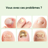 Gouttes magiques pour réparer les ongles