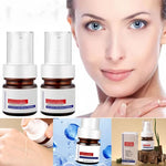 Crème visage anti-taches de rousseur à la vitamine C