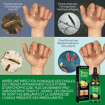 Traitement des ongles au gingembre