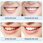 Super Probiotic-6 Pasta Dental Blanqueadora con Probióticos