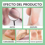 Eliminador de Callos para Pies