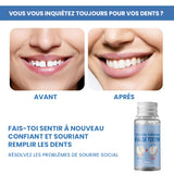 Fausses dents moulables pour les obturations dentaires temporaires