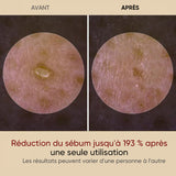Ampoule exfoliante douce – Riz noir