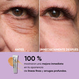 Tensador temporal de ojos