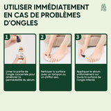 Gouttes magiques pour réparer les ongles
