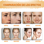 Jabón de limón, cúrcuma y ácido kójico