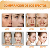 Jabón de limón, cúrcuma y ácido kójico