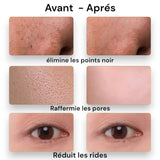 Spatule exfoliante pour le visage
