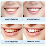 Dentifrice Super Probiotic-6