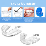 Orthodontie Garde de Redressement
