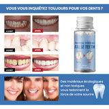 Fausses dents moulables pour les obturations dentaires temporaires