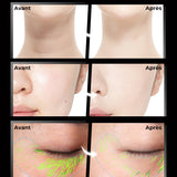 Masseur Liftant et Raffermissant