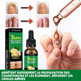 Traitement des ongles au gingembre
