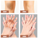 Crème assombrissante pour les articulations