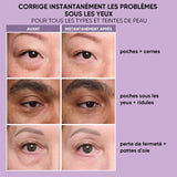 Tenseur temporaire pour les yeux