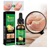 Traitement des ongles au gingembre