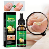 Traitement des ongles au gingembre