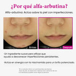 Suero Intensivo Despigmentante
