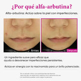 Suero Intensivo Despigmentante