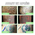 Crème éclaircissante pour tatouage