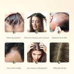 Shampooing au gingembre contre la chute des cheveux