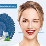 Blanchiment des dents – Rapide. Doux. Sans résidus