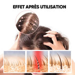 Shampooing au gingembre contre la chute des cheveux