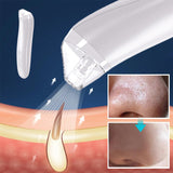 Kit de Traitement des Comédons