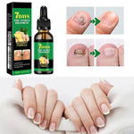 Traitement des ongles au gingembre