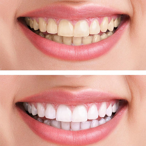 Dentifrice à l'hydroxyapatite