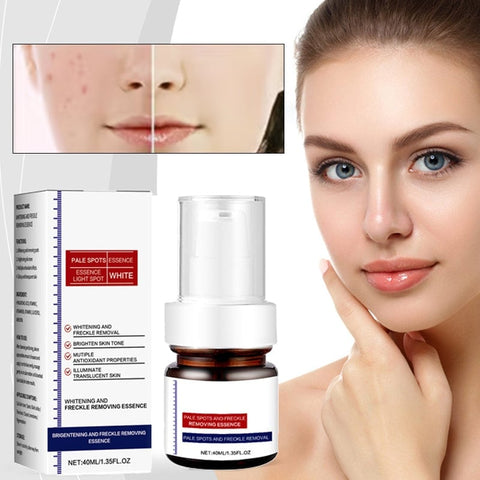 Crème visage anti-taches de rousseur à la vitamine C