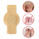 Plaques fongiques sur les ongles