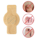 Plaques fongiques sur les ongles