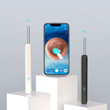 Wi-Fi Visible Wax Elimination Spoon, USB HD Load Otoscope