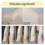 Eponge Exfoliante Ultra Douce