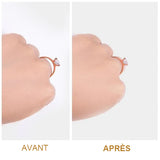 Redimensionneur de Bague