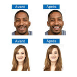 Dentier Amovible - Pour Un Sourire Plus Confiant