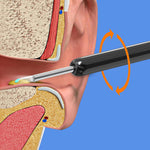Wi-Fi Visible Wax Elimination Spoon, USB HD Load Otoscope