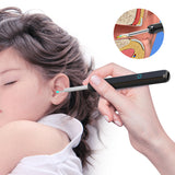 Wi-Fi Visible Wax Elimination Spoon, USB HD Load Otoscope